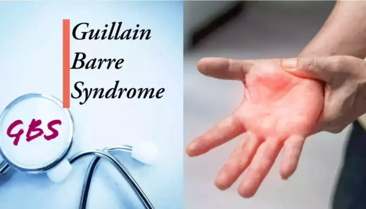 Guillain-Barre Syndrome